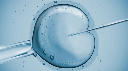 تطبيق Mini-IVF في طريقة Tandem